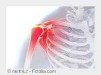 Orthopäde in Heidelberg: Wie wirkt Lasertherapie?