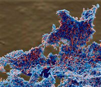 Deutsche Biotechnologie in den USA: Wirkstoff für Millionen Helicobacter-Betroffene
