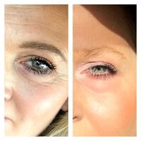 Quantensprung in der Kosmetik und Hautpflege