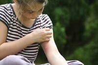 Mückenstiche vermeiden und richtig behandeln - Saisonale Verbraucherinformation der DKV