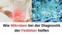 Wie Mikroben bei der Diagnostik der Fettleber helfen