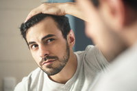 Haartransplantation nur in Ausnahmefällen absetzbar