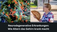 Neurodegenerative Erkrankungen: Wie Altern das Gehirn krank macht